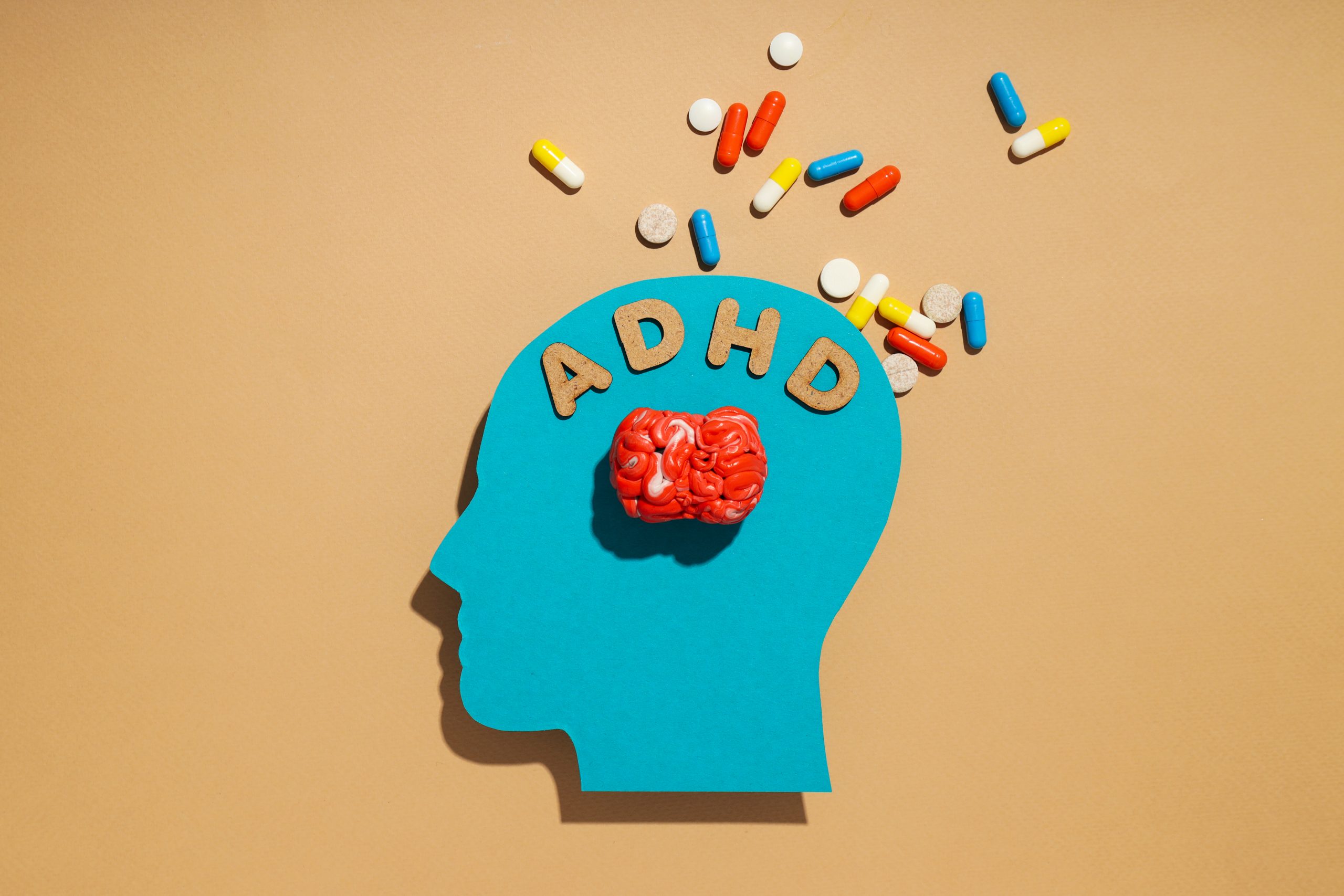 a human head outline with the brain and the words ADHD inside and pills spilling out, representing the connection between drug addiction and adhd.