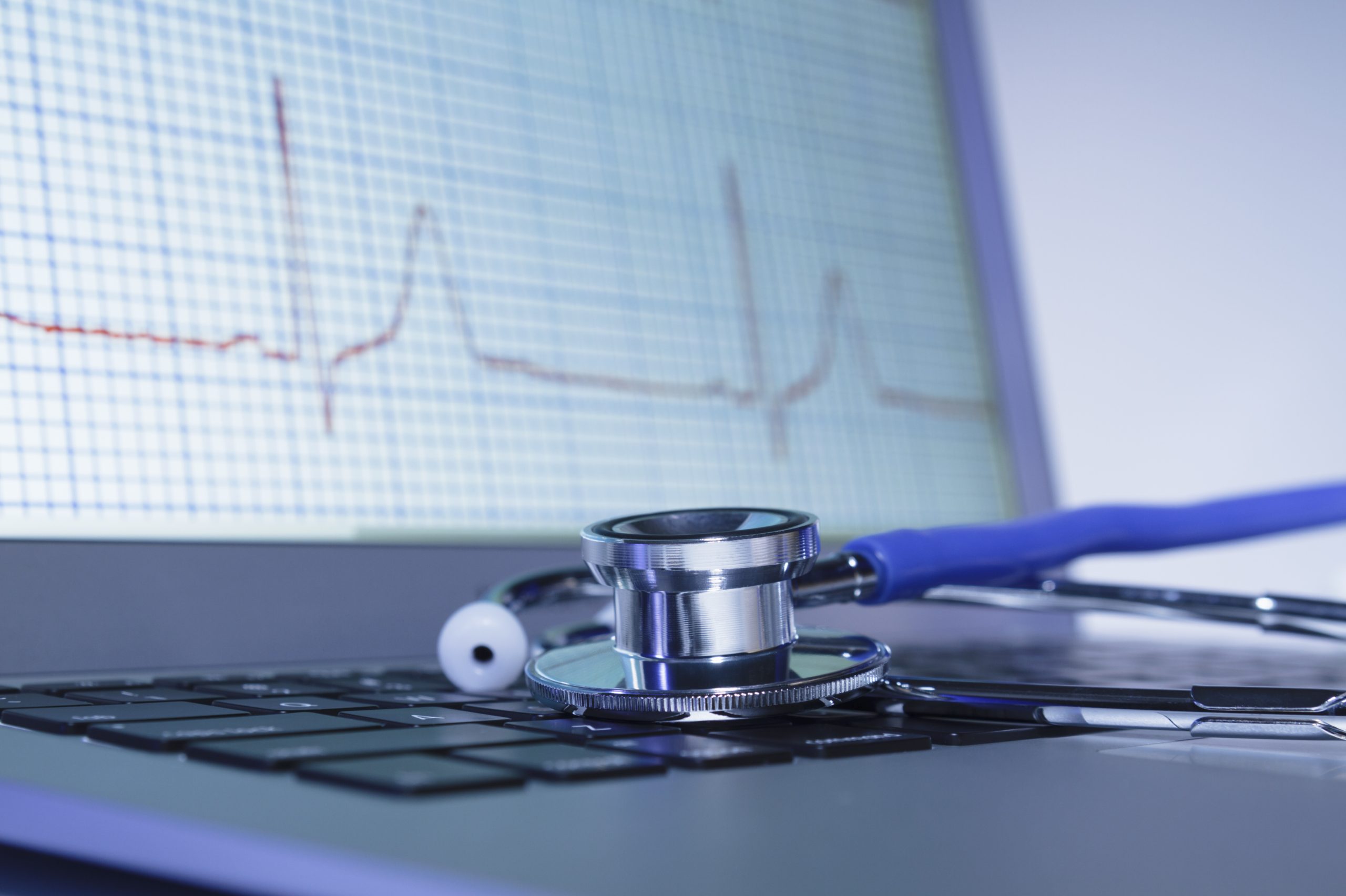 a stethoscope sitting on a laptop with an ECG trace on the screen wot show effects of common alcohol stroke symptoms