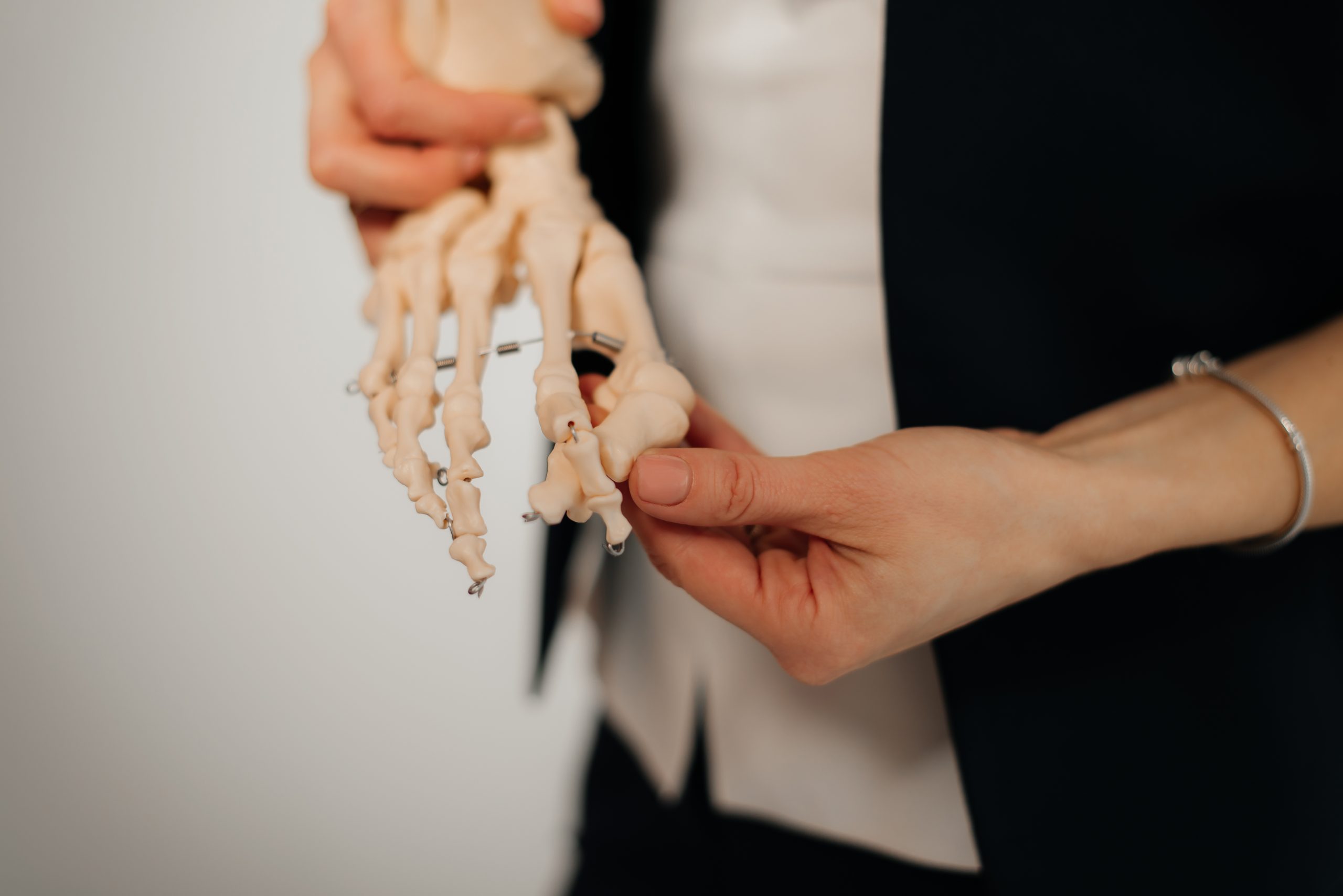 woman holding bones of a human foot to show relationship between alcohol and osteoporosis